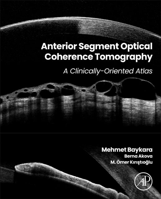 Anterior Segment Optical Coherence Tomography: A Clinically-Oriented Atlas