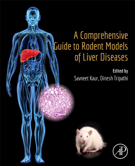 A Comprehensive Guide to Rodent Models of Liver Diseases