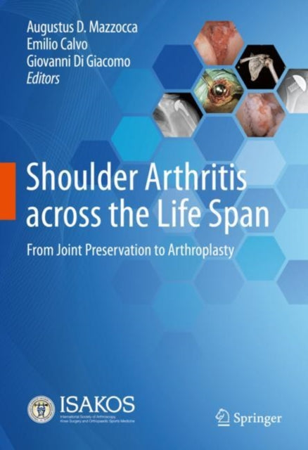 Shoulder Arthritis across the Life Span: From Joint Preservation to Arthroplasty
