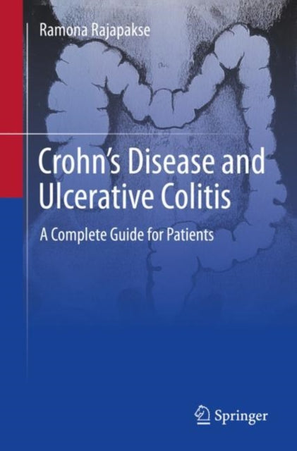 Crohn's Disease and Ulcerative Colitis: A Complete Guide for Patients