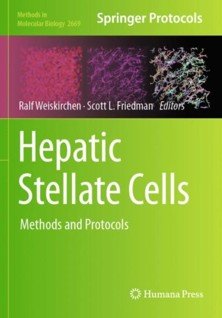 Hepatic Stellate Cells: Methods and Protocols