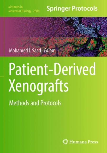 Patient-Derived Xenografts: Methods and Protocols