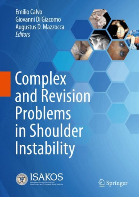 Complex and Revision Problems in Shoulder Instability