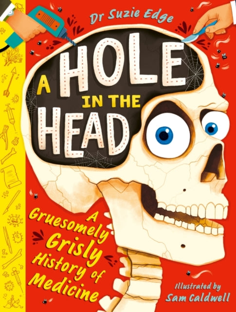 A Hole in the Head: A gruesomely grisly history of medical firsts