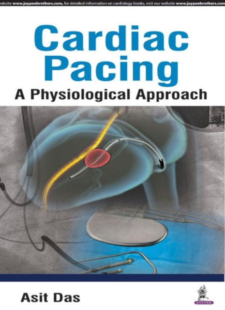 Cardiac Pacing: A Physiological Approach