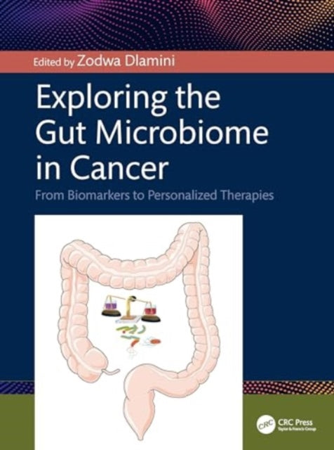Exploring the Gut Microbiome in Cancer: From Biomarkers to Personalized Therapies