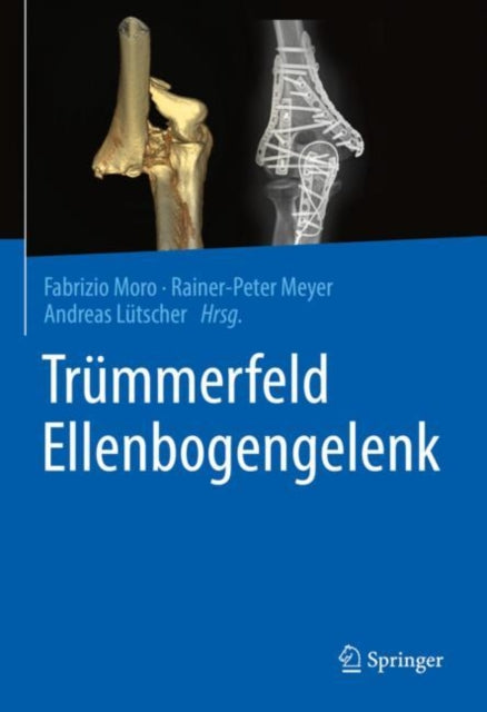 Trummerfeld Ellenbogengelenk