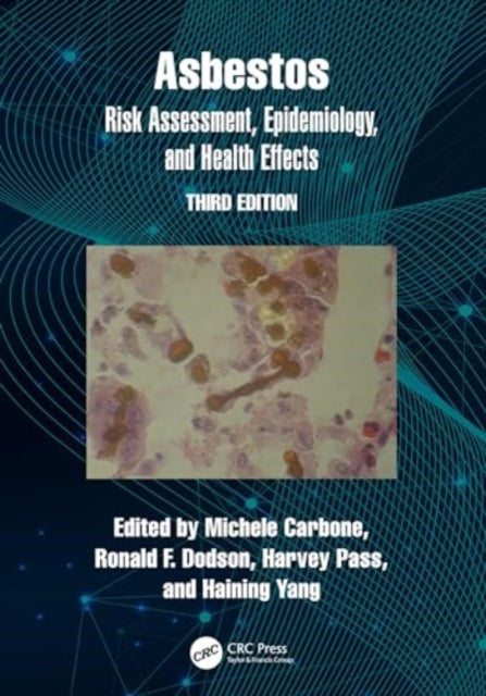 Asbestos: Risk Assessment, Epidemiology, and Health Effects