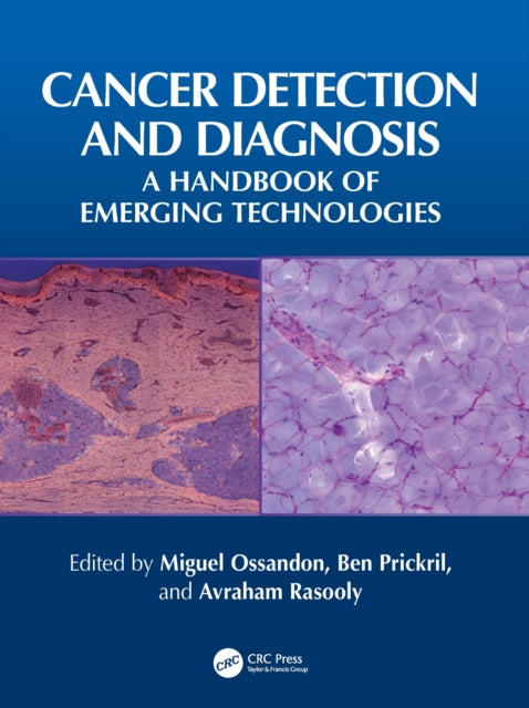 Cancer Detection and Diagnosis: A Handbook of Emerging Technologies
