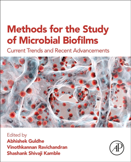 Methods for the Study of Microbial Biofilms: Current Trends and Recent Advancements