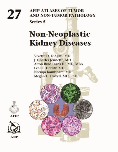 Non-Neoplastic Kidney Diseases