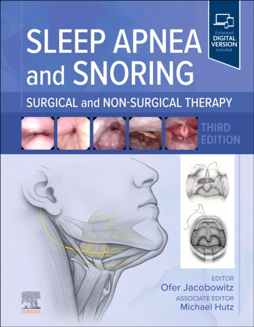 Sleep Apnea and Snoring cover