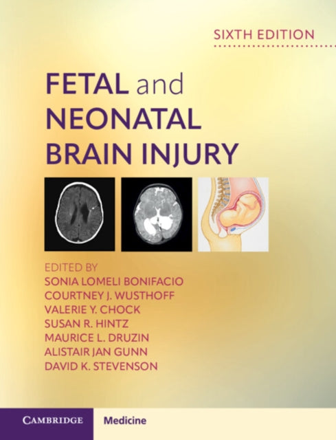 Fetal and Neonatal Brain Injury cover