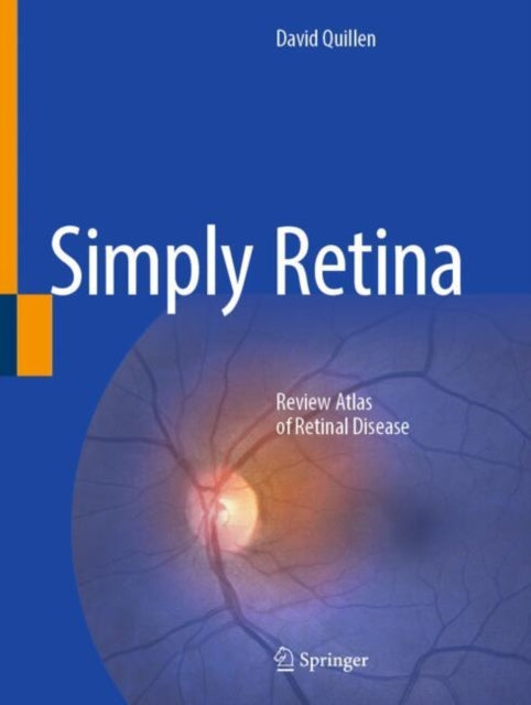 Simply Retina cover