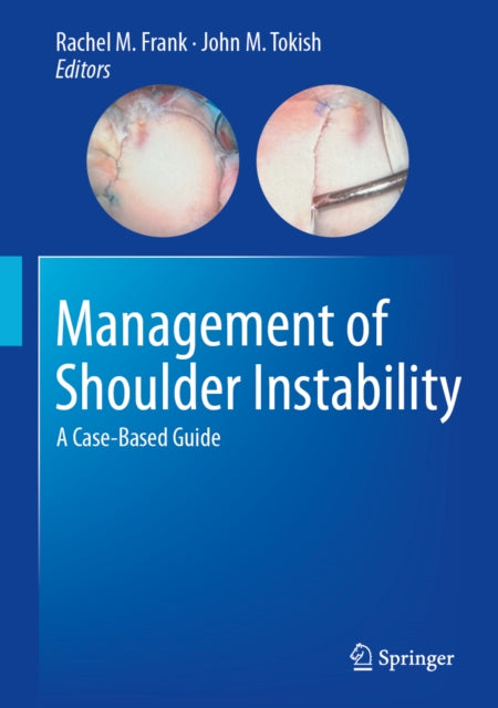 Management of Shoulder Instability cover