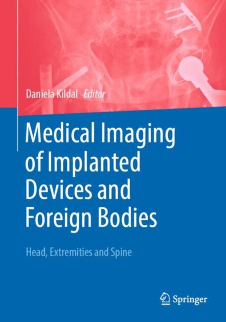 Medical Imaging of Implanted Devices and Foreign Bodies cover