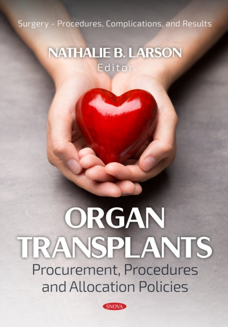 Organ Transplants: Procurement, Procedures and Allocation Policies cover