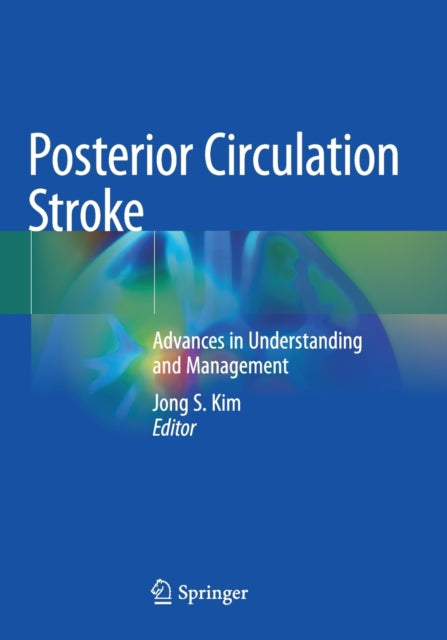 Posterior Circulation Stroke: Advances in Understanding and Management