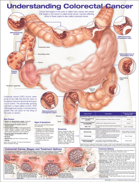 Understanding Colorectal Cancer Anatomical Chart