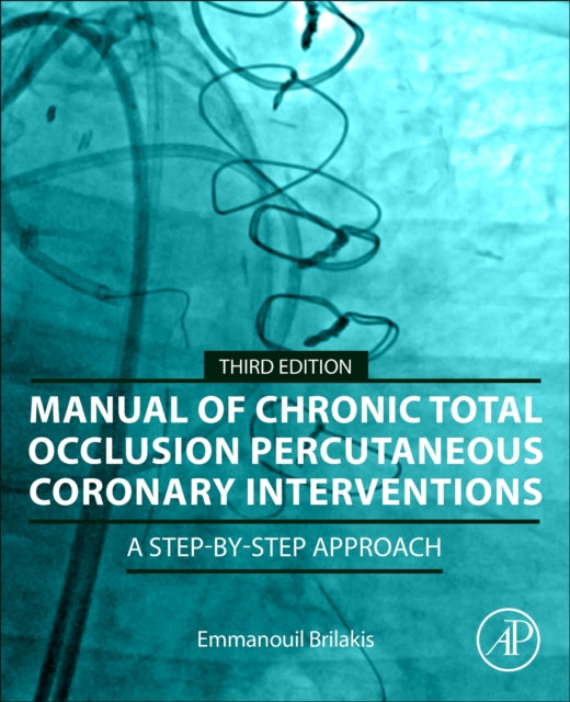 Manual of Chronic Total Occlusion Percutaneous Coronary Interventions: A Step-by-Step Approach
