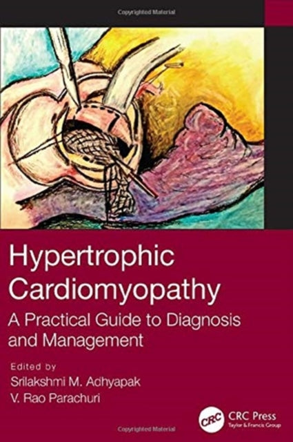 Hypertrophic Cardiomyopathy: A Practical Guide to Diagnosis and Management