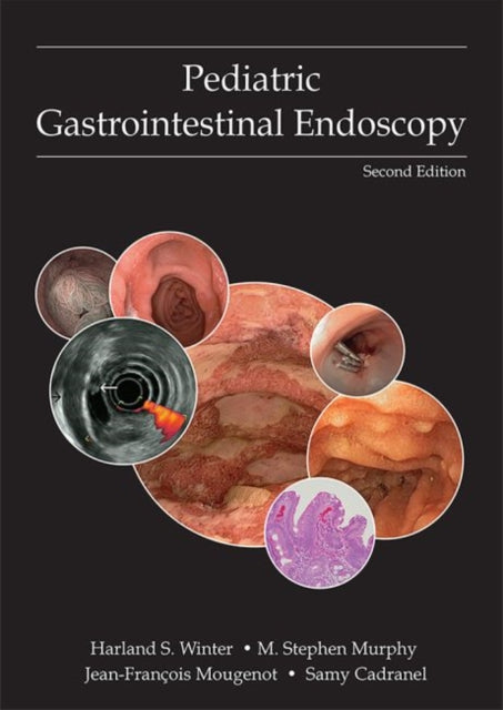 Atlas of Pediatric Gastrointestinal Endoscopy 2/e