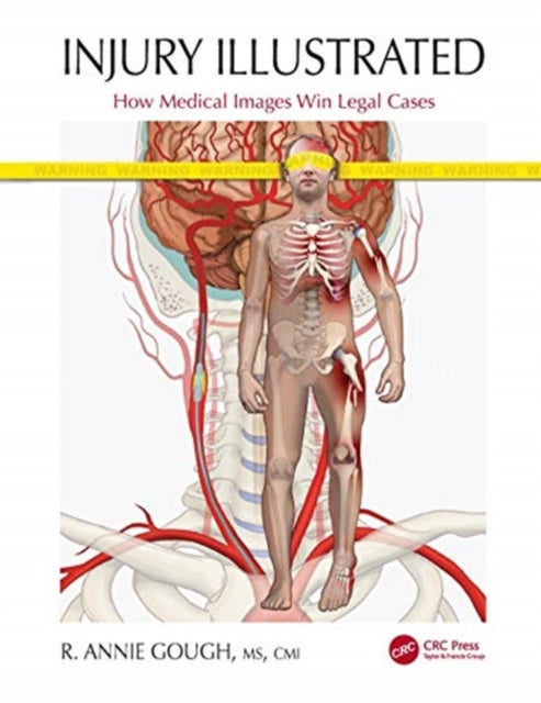 Injury Illustrated: How Medical Images Win Legal Cases