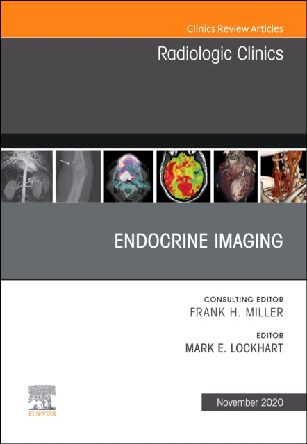 Endocrine Imaging , An Issue of Radiologic Clinics of North America
