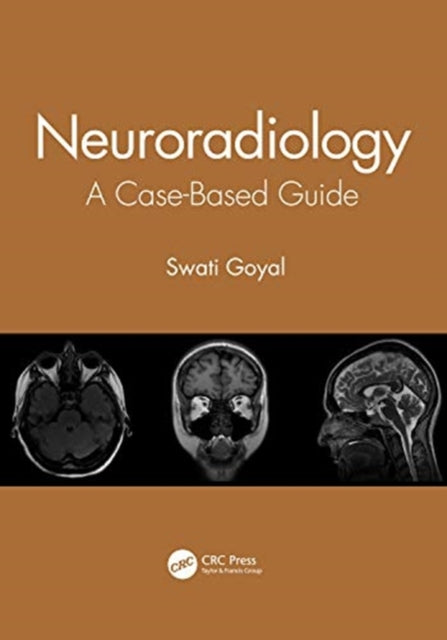 Neuroradiology: A Case-Based Guide