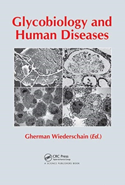Glycobiology and Human Diseases