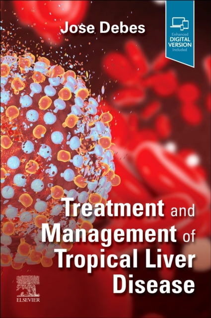 Treatment and Management of Tropical Liver Disease