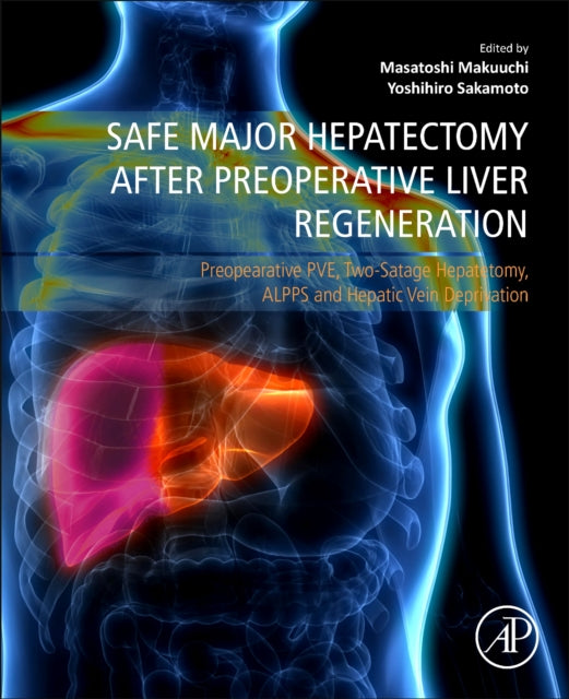 Safe Major Hepatectomy after Preoperative Liver Regeneration: Preopearative PVE, Two-Satage Hepatetomy, ALPPS and Hepatic Vein Deprivation