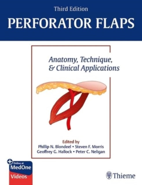 Perforator Flaps: Anatomy, Technique, & Clinical Applications