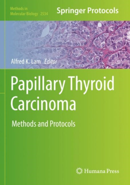 Papillary Thyroid Carcinoma: Methods and Protocols