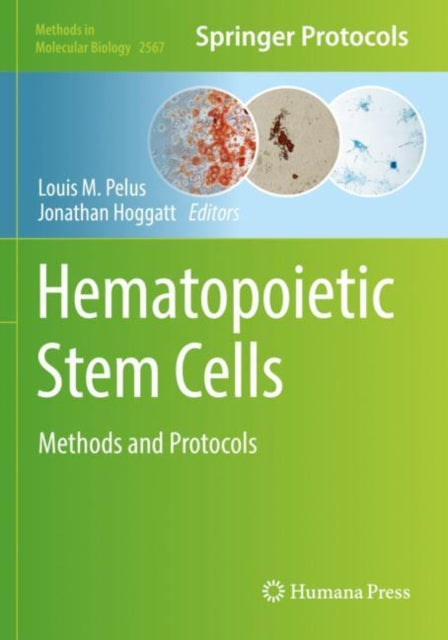 Hematopoietic Stem Cells: Methods and Protocols