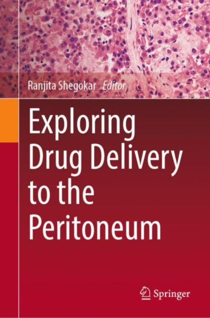 Exploring Drug Delivery to the Peritoneum