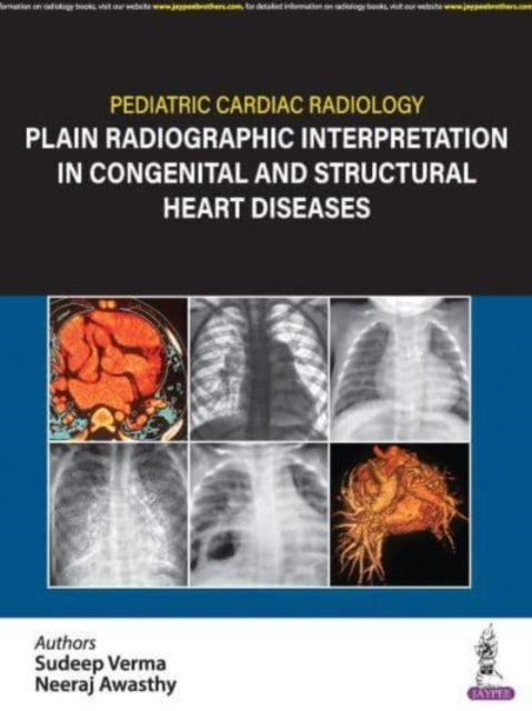 Pediatric Cardiac Radiology: Plain Radiographic Interpretation in Congenital and Structural Heart Diseases