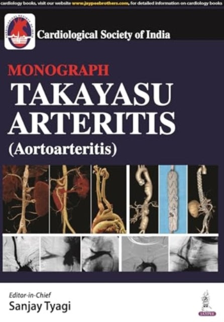 Takayasu Arteritis (Aortoarteritis)