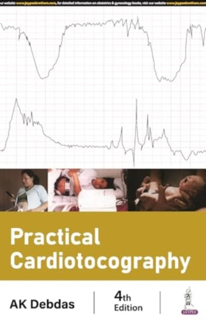 Practical Cardiotocography