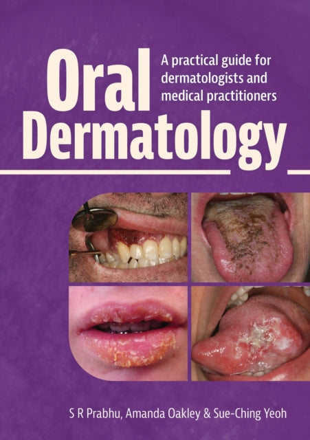 Oral Dermatology: A practical guide for dermatologists and medical practitioners