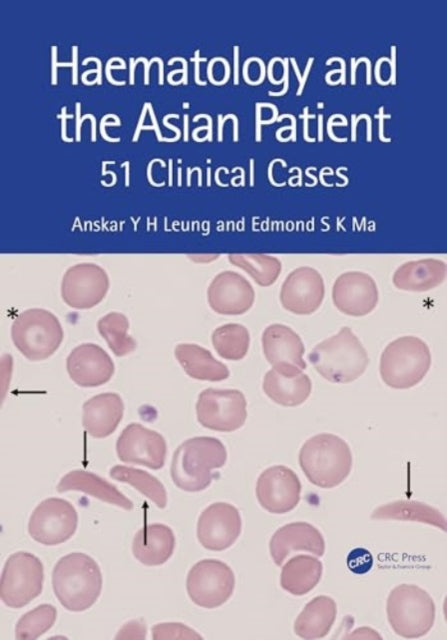 Haematology and the Asian Patient: 51 Clinical Cases