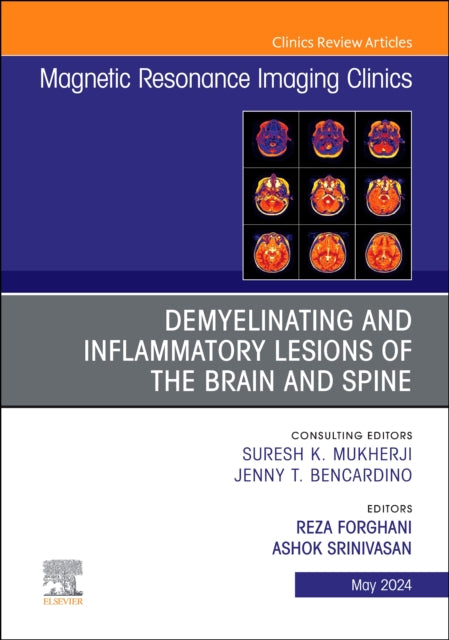 Demyelinating and Inflammatory Lesions of the Brain and Spine, An Issue of Magnetic Resonance Imaging Clinics of North America