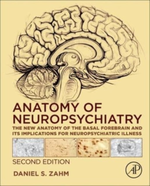 Anatomy of Neuropsychiatry: The New Anatomy of the Basal Forebrain and Its Implications for Neuropsychiatric Illness