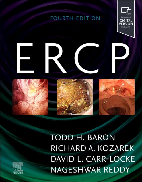 ERCP