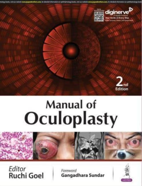 Manual of Oculoplasty