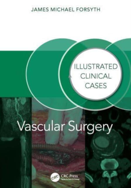 Vascular Surgery:: Illustrated Clinical Cases