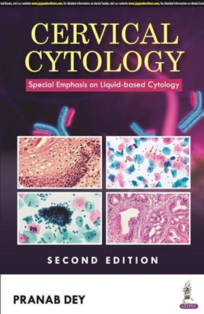 Cervical Cytology: Special Emphasis on Liquid-based Cytology