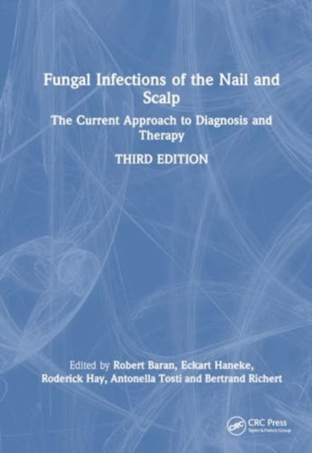 Fungal Infections of the Nail and Scalp: The Current Approach to Diagnosis and Therapy