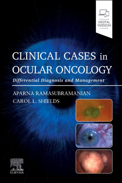 Clinical Cases in Ocular Oncology: Differential Diagnosis and Management