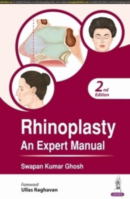 Rhinoplasty: An Expert Manual